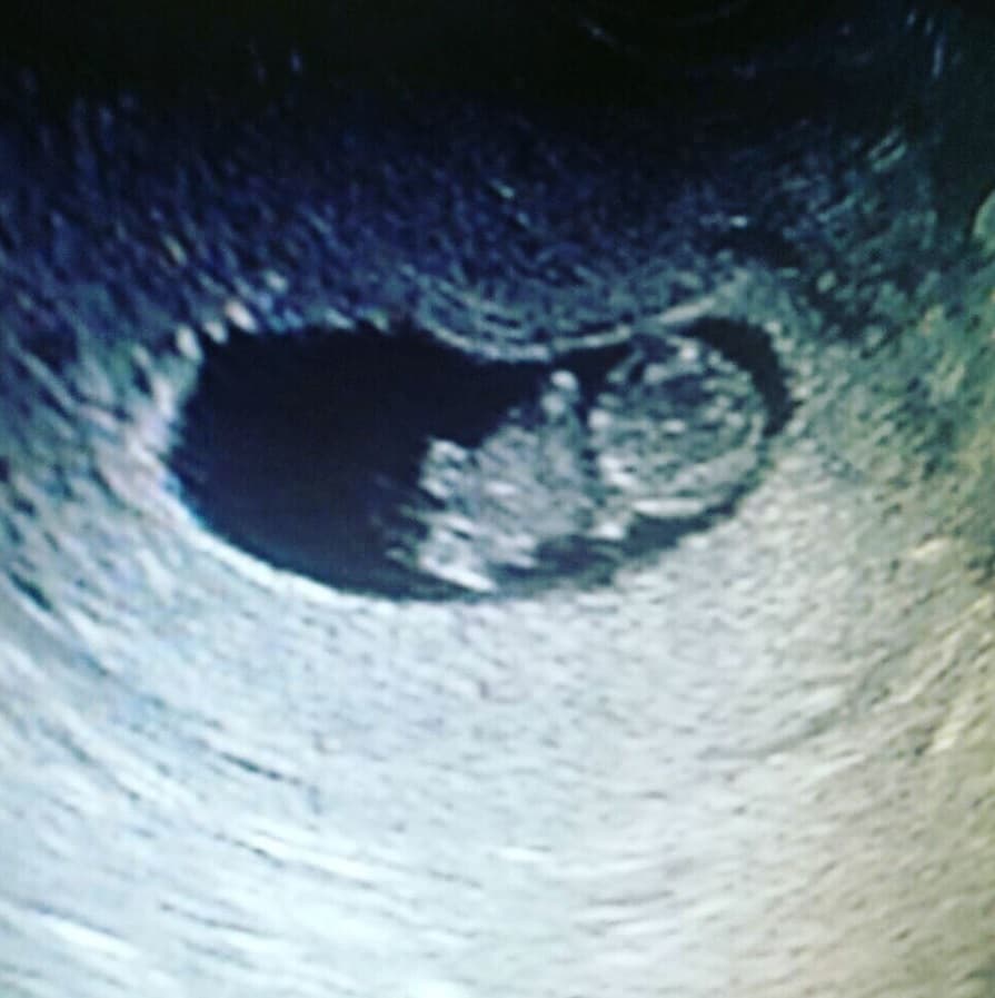 Juanchi Torre y su esposa Marcela Gómez anunciaron la tierna espera de su segundo hijo.