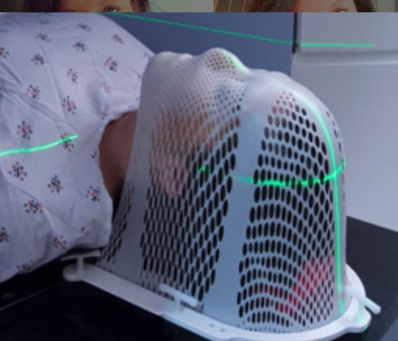 Tras la cirugía, Amanda continúa con su tratamiento, el cual consiste en 
<b>radiaciones y quimioterapias</b>.
<br>