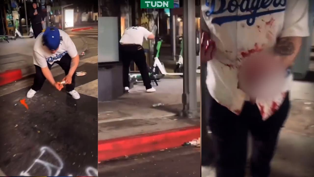 Tragedia en Los Angeles, cuete explota en mano de aficionado de Dodgers 