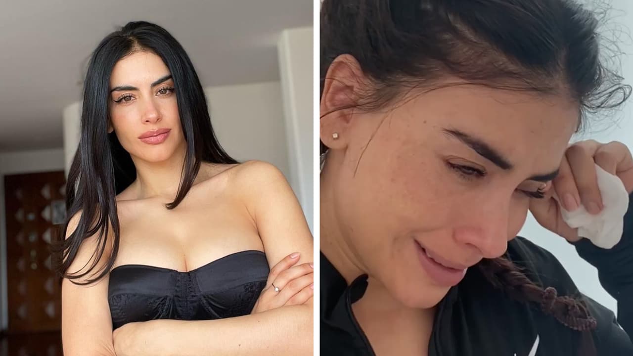 Jessica Cediel comparte fuertes imágenes tras años de batallar contra los biopolímeros