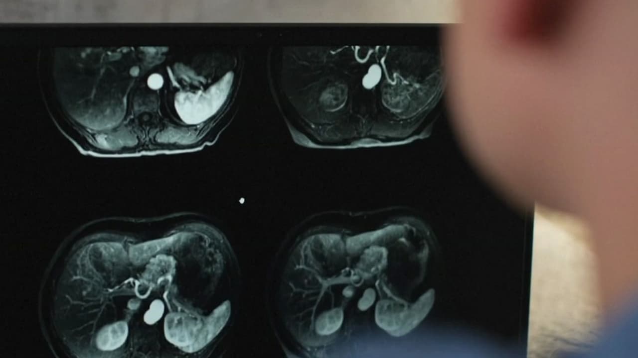 Esperanza contra el cáncer de páncreas: Píldora experimental podría duplicar la supervivencia de pacientes