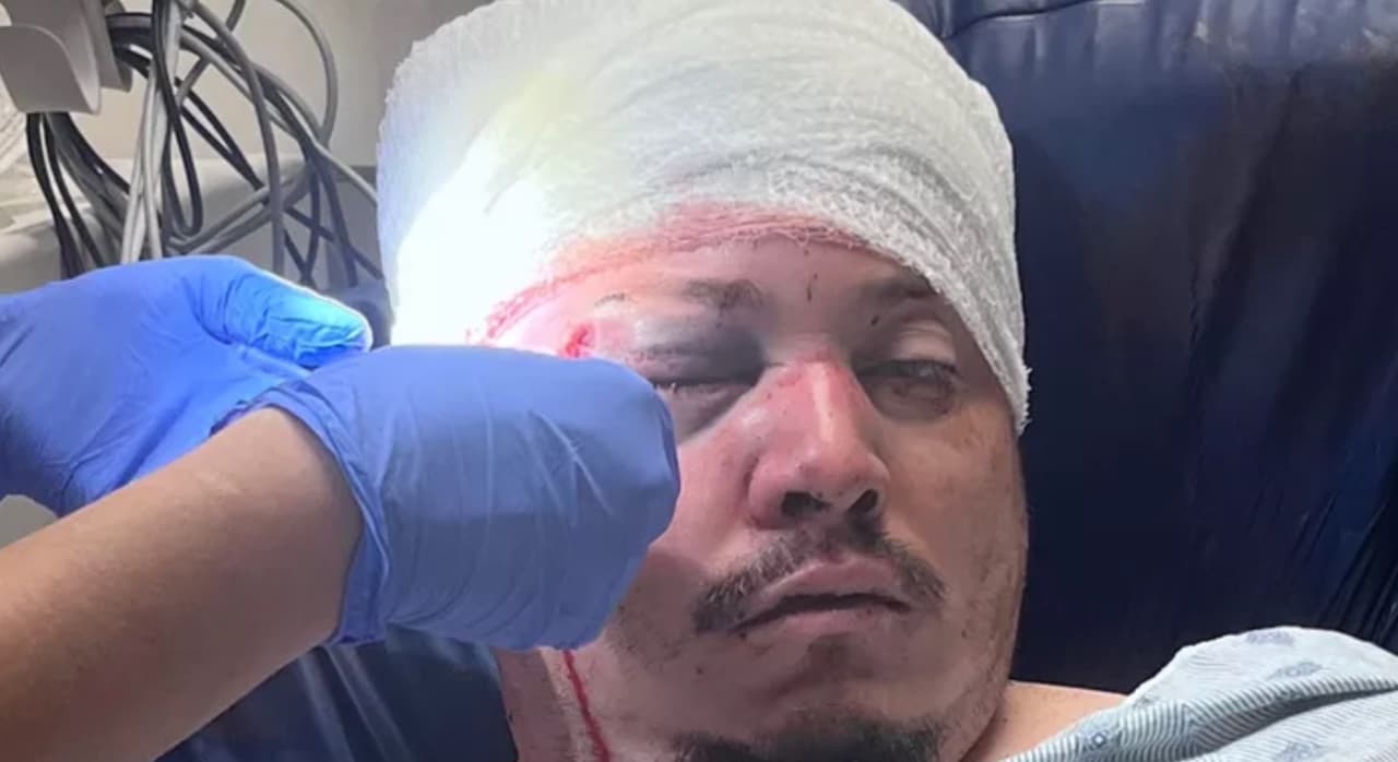 Dejan grave a padre hispano de 7 hijos; esposa denuncia que lo golpearon para no pagarle por su trabajo