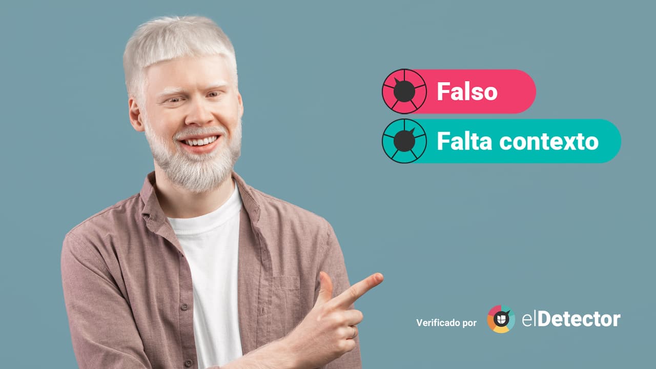 "Es contagioso": desmontamos esta y otras dos creencias sobre el albinismo en su día internacional