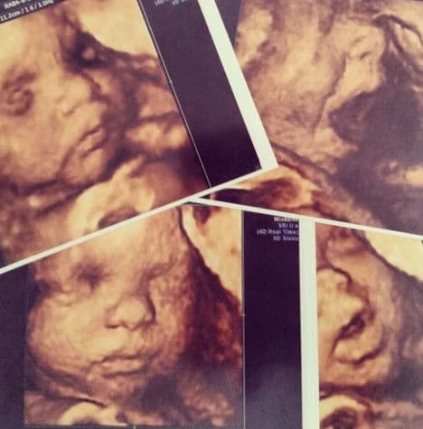 En Rubén & Co pudimos ver en 4D a #BabyCompany, la pequeña Kamilia que está en la barriguita de Gredmarie