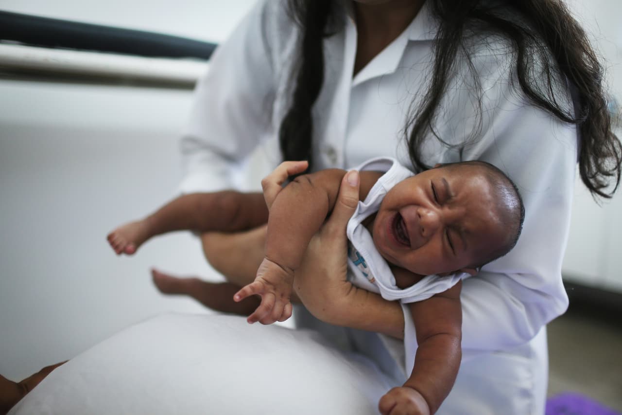 Puerto Rico confirma nacimiento del primer bebé con microcefalia vinculada a zika