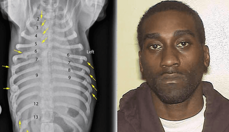 Hombre del Bronx golpeó a su perro hasta la muerte