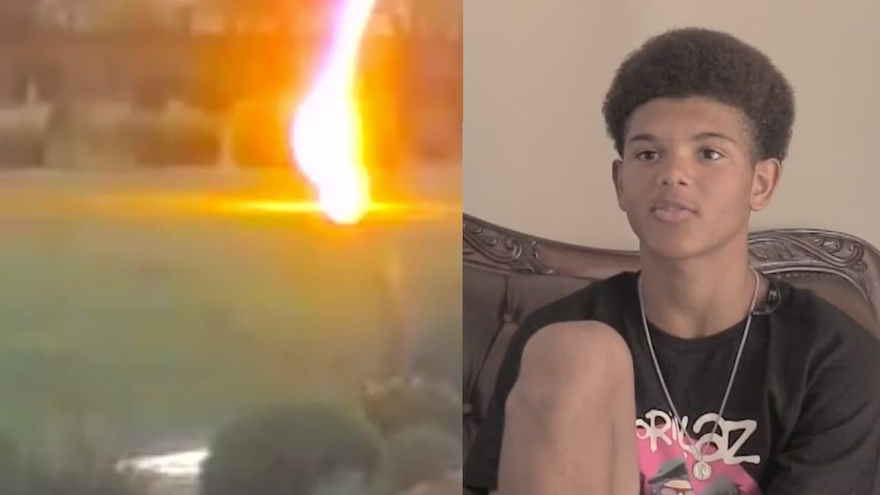 Este joven fue golpeado por un rayo, sufrió un paro cardiaco, estuvo tres días en coma y sobrevivió 