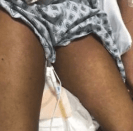 Aunque podría ser algo poco común, los expertos recomiendan llevar a su hijo al doctor si observa alguno de estos síntomas.