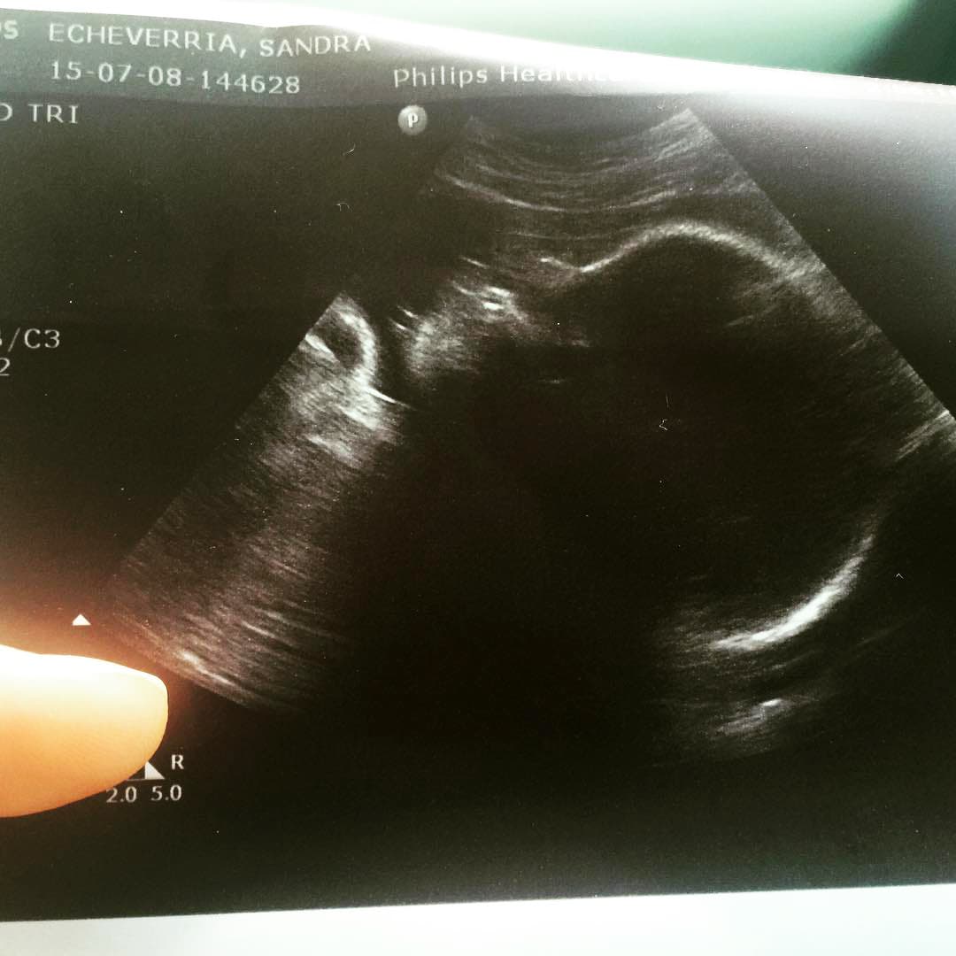 Nuestra querida actriz está completamente feliz por este acontecimiento y junto con Leo, ya decidió el nombre de su pequeño.