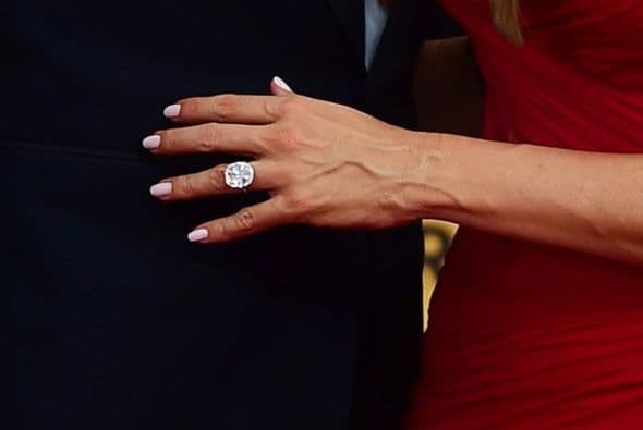 ¡Su anillote de compromiso!