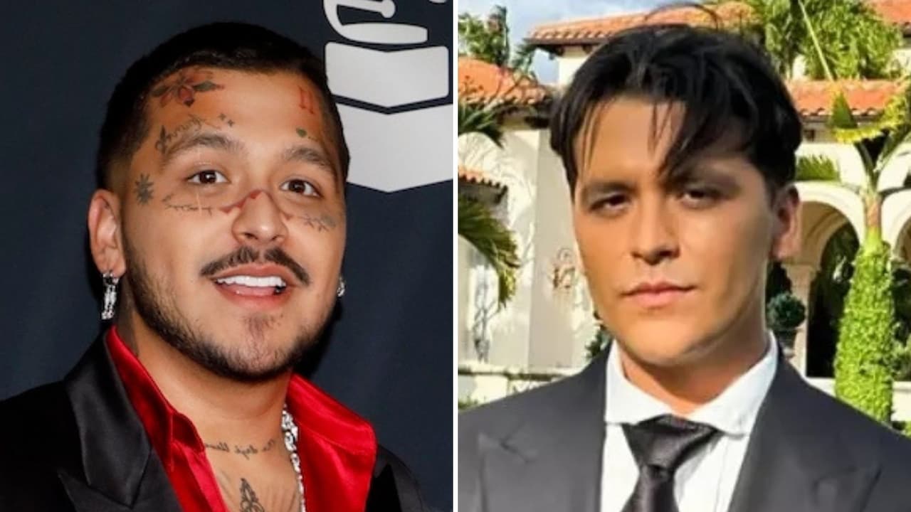 Nodal revela las lesiones que le quedan tras quitarse los tatuajes del rostro: “Llagas, como si te quemaras”