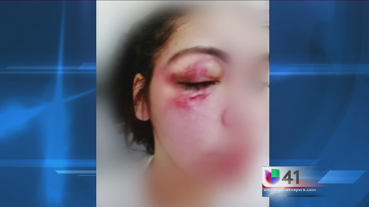 Detona más violencia un pleito por “hoverboard” en mercado de Brooklyn 