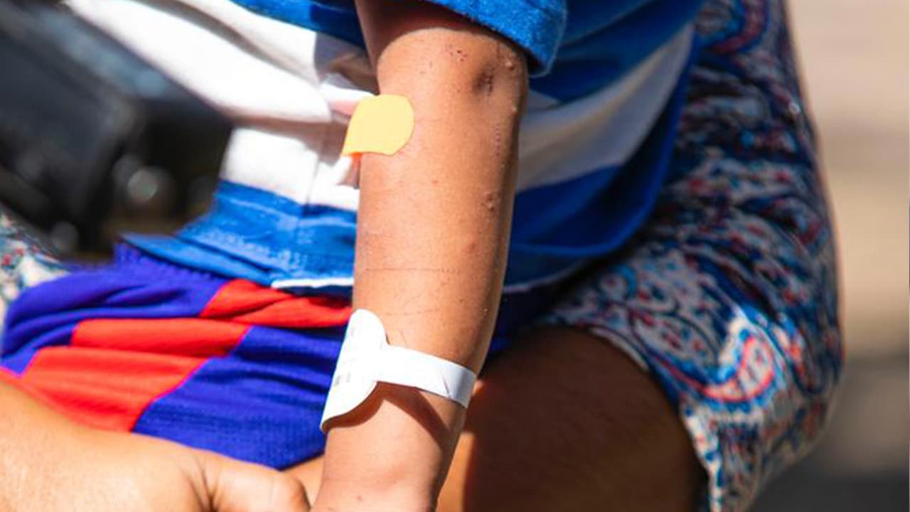 Aunque está bien de salud, se pudo evidenciar los raspones que sufrió el pequeño en sus brazos y piernas.