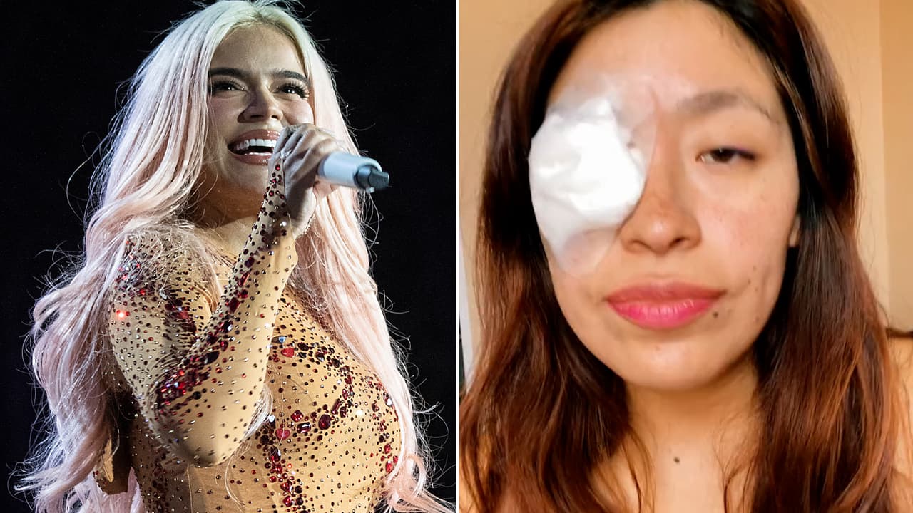 Fan de Karol G casi pierde un ojo en pleno concierto de la cantante: esto pasó