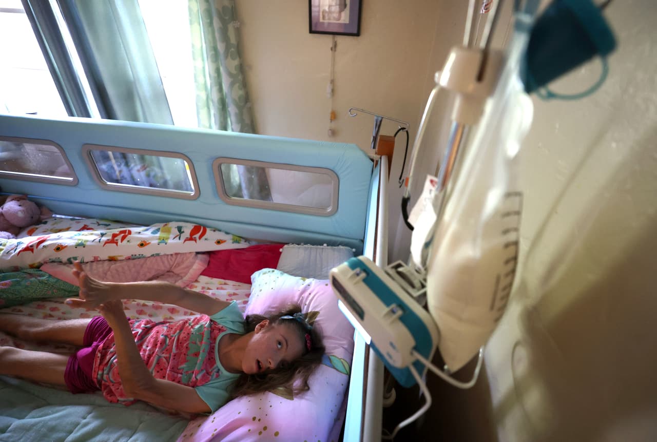 Además, afecta la capacidad intelectual, provocando limitaciones en la comunicación verbal en algunos casos.