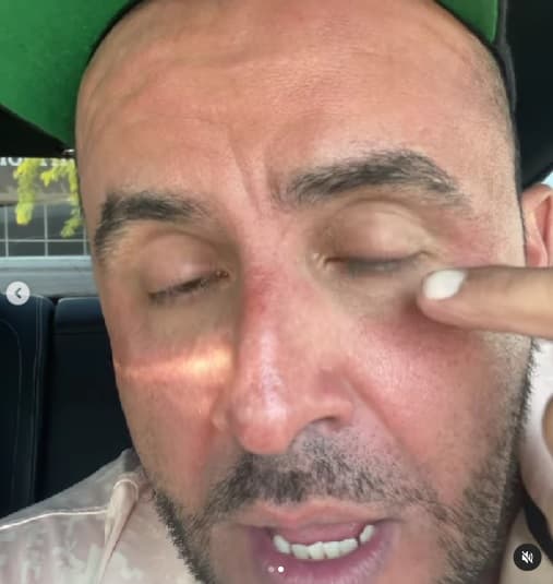 “Hoy es el primer día. Día tras día les iré enseñando el proceso de todo el rollo. Creo que mañana se me empieza a caer la piel, a descarapelar”, indicó.
<br>