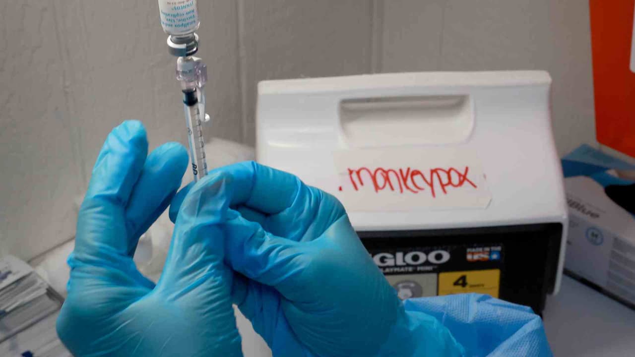 Mpox en el DMV: ha habido casos en nuestra región, mira cómo se contagia