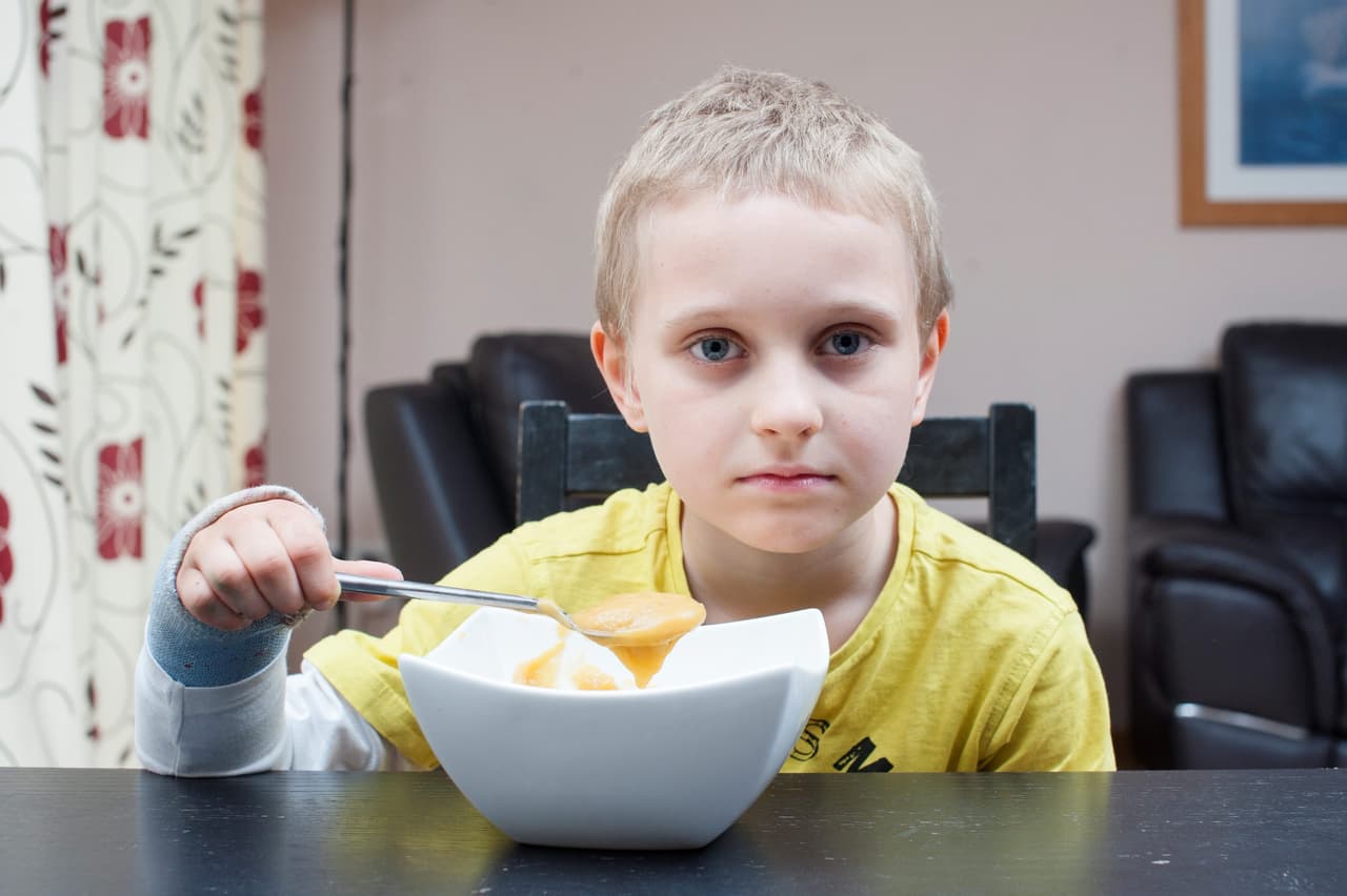 Para Oxana no ha sido fácil llevar la situación como lo dijo "se hace la vida tan difícil. Si trato de darle de comer algo que no sea sopa, llora y entra en pánico. Él tiene miedo de atragantarse, él ni siquiera se come un plátano".