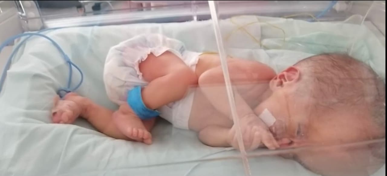 Sin embargo, tras un tiempo en incubadora, Jaimy decidió proteger a su bebé y lo ocultó durante un par de meses -incluso de su 
<a href="https://www.univision.com/temas/familia">familia</a>- 
<b>porque no iba a permitir que nadie se burlara de la apariencia de su hijo. </b>
<br>