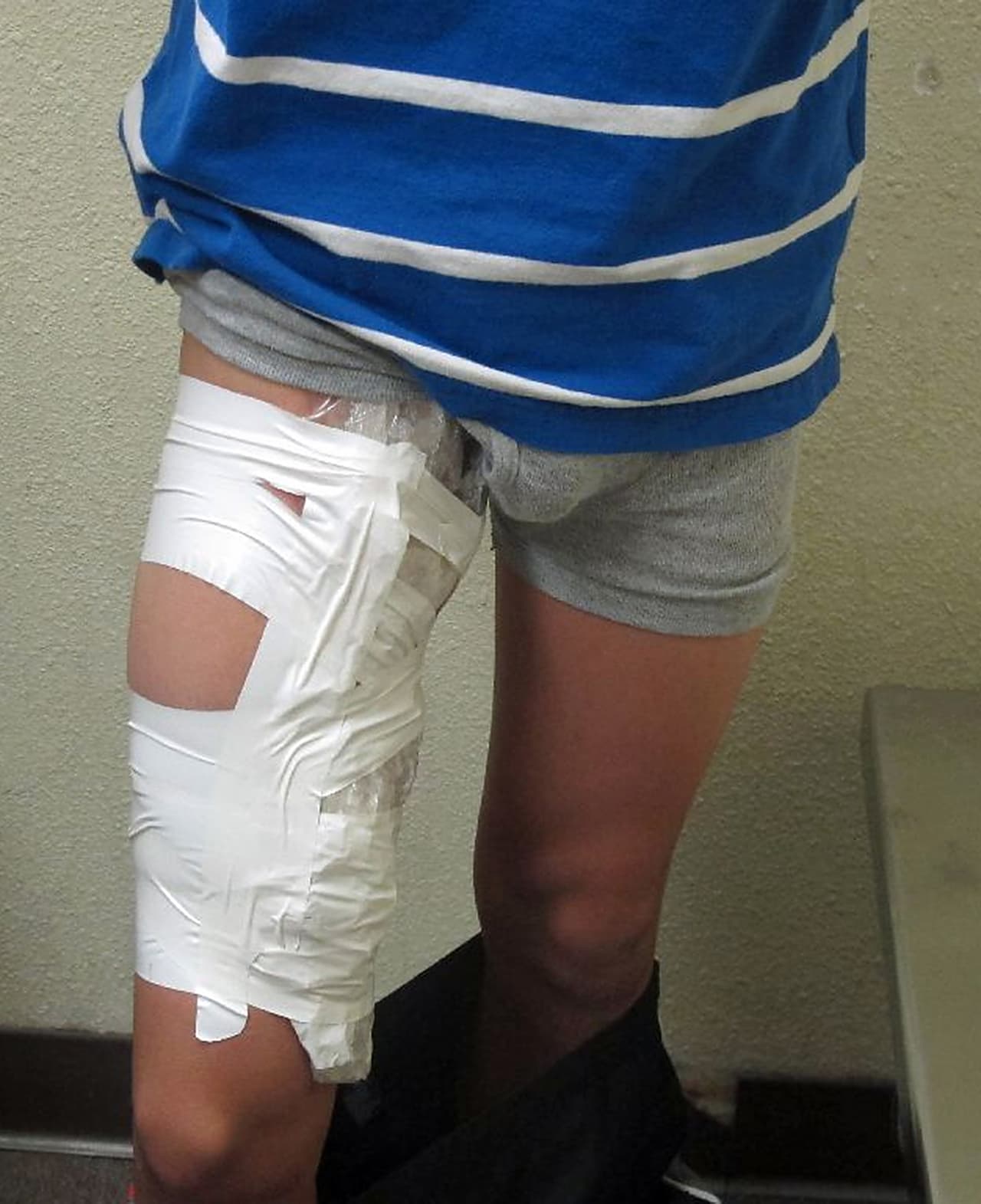 El paquete. Metanfetamina adherida a la entrepierna.