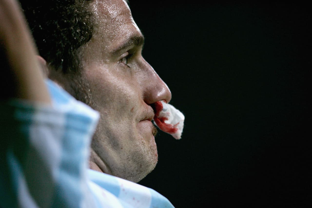 Cómo es vivir con hemofilia, la enfermedad de la hemorragias