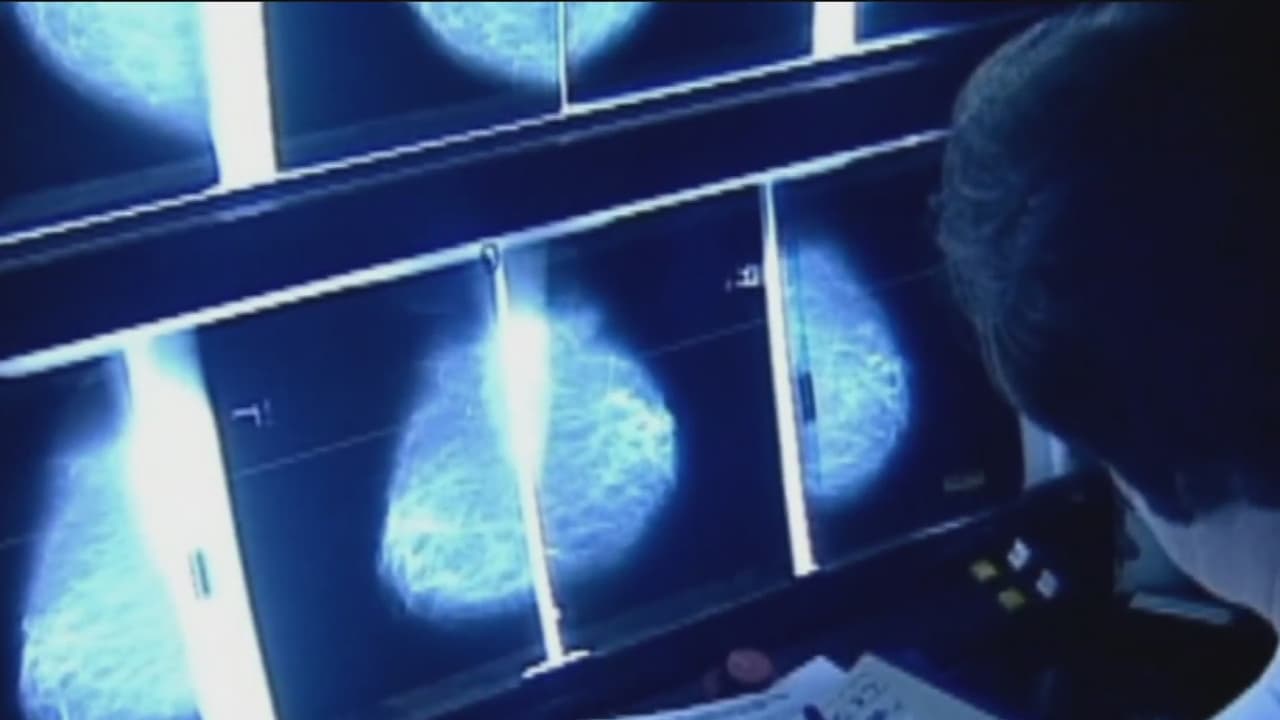 Científicos desarrollan una nueva prueba para detectar en 10 minutos la presencia de cáncer en pacientes