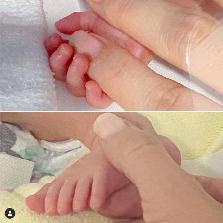 Más tarde, el día 27, Estela publicó la primera foto de sus hijas en donde solo se pueden apreciar sus extremidades, en el mensaje que escribió informó que 
<b>habían nacido prematuras</b>.
<br>