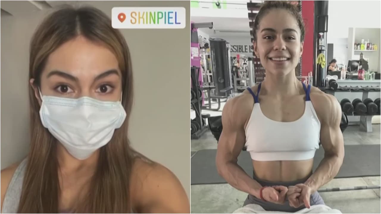 Influencer muere tras procedimiento médico que era parte de una campaña publicitaria