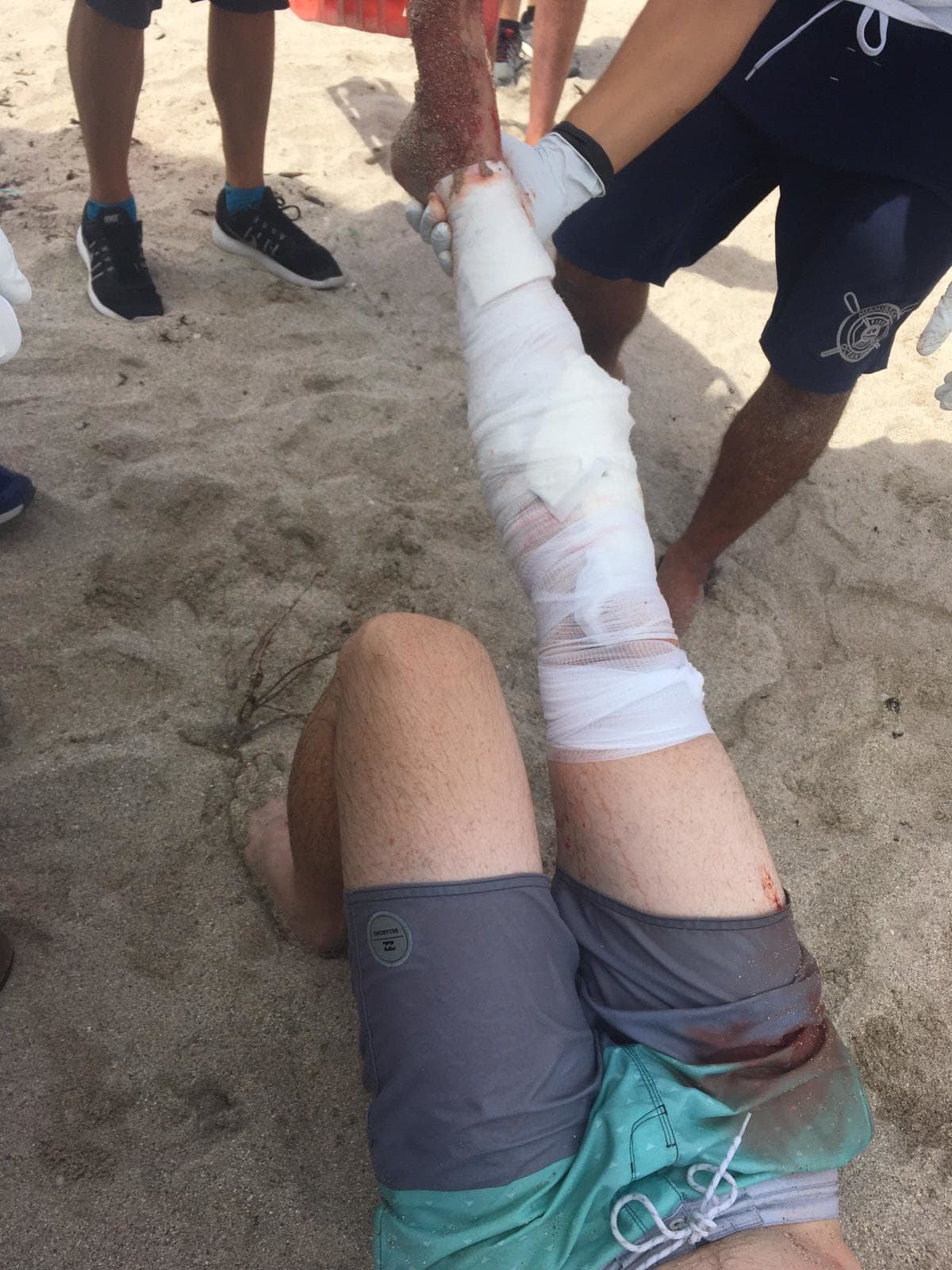 Afortunadamente los servicios de rescatistas de Miami Beach llegaron pronto y asistieron a la víctima de este ataque. 
<br>