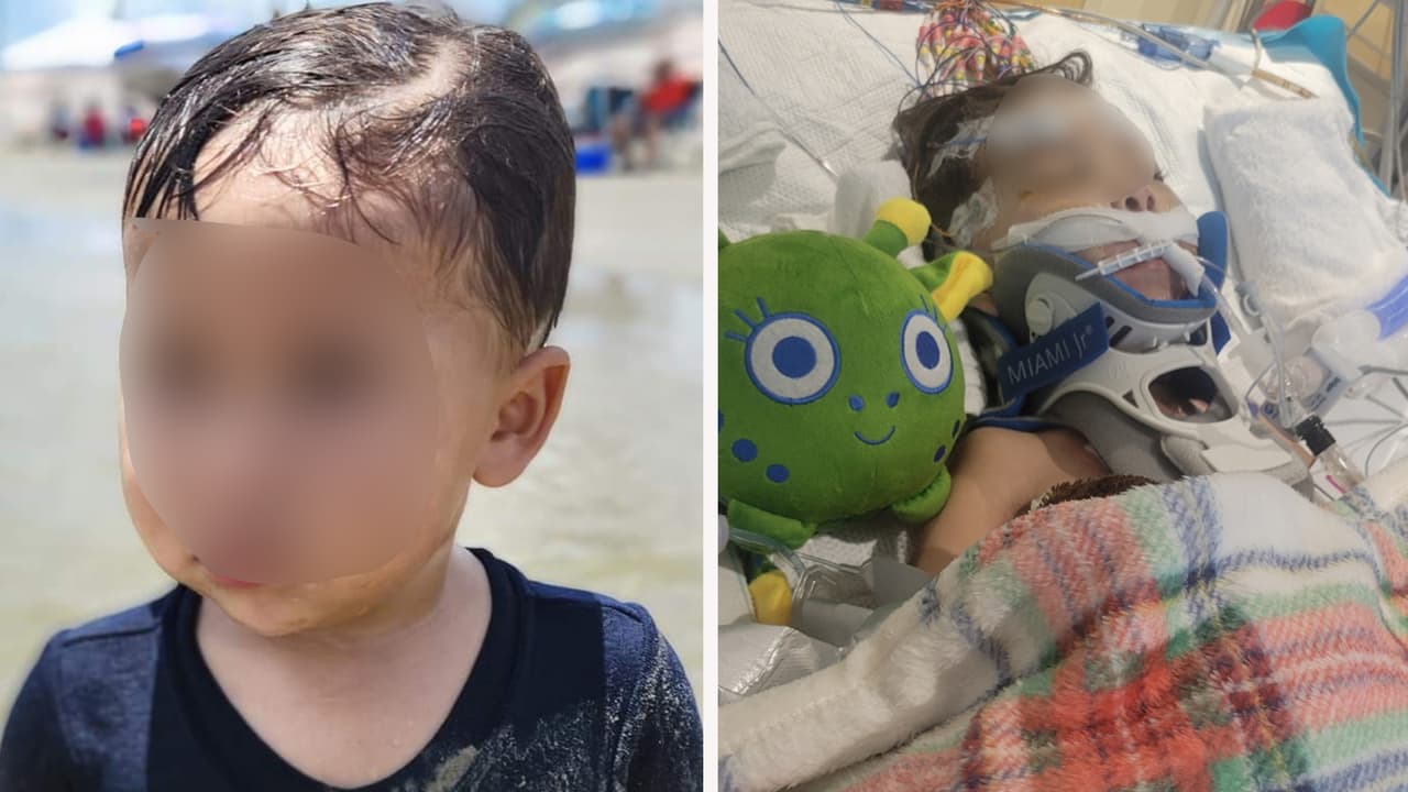 "El novio golpeó al niño y lo dejó en coma": Acusan a una mujer de permitir el abuso de su hijo de 3 años 