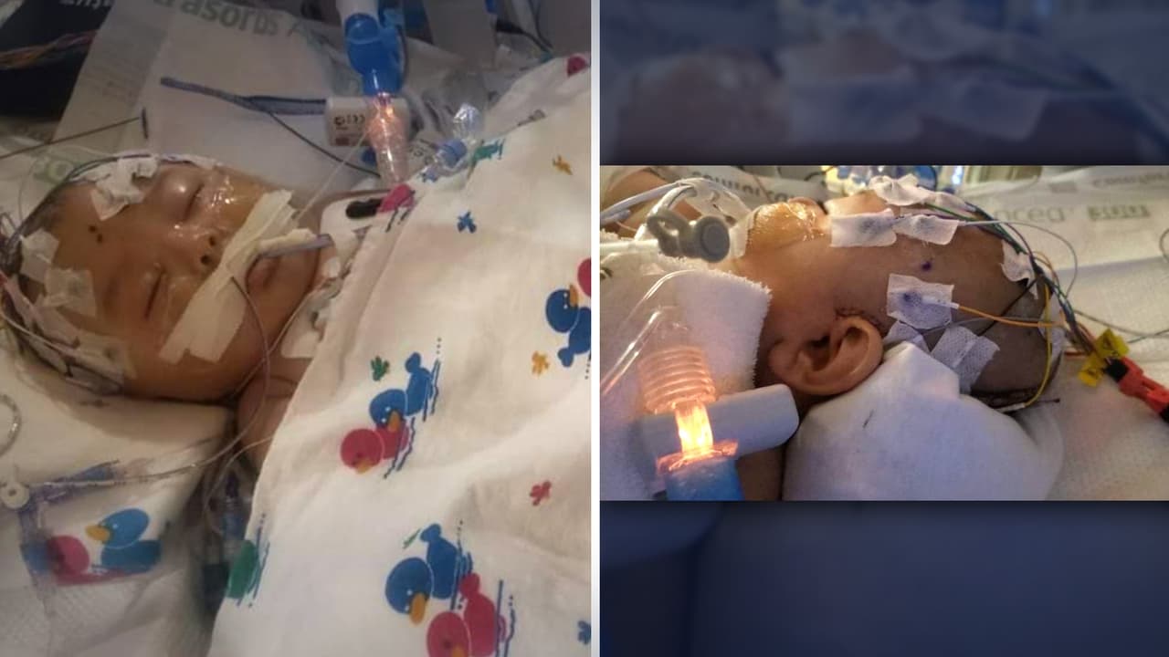 "¡Bendito sea Dios! Ya salió de la operación del cerebro": madre del bebé Adrián habla sobre estado de su hijo