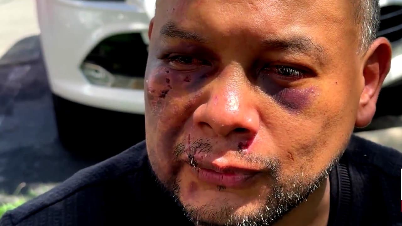Policía investiga presunta agresión de agentes de ICE contra migrante mexicano