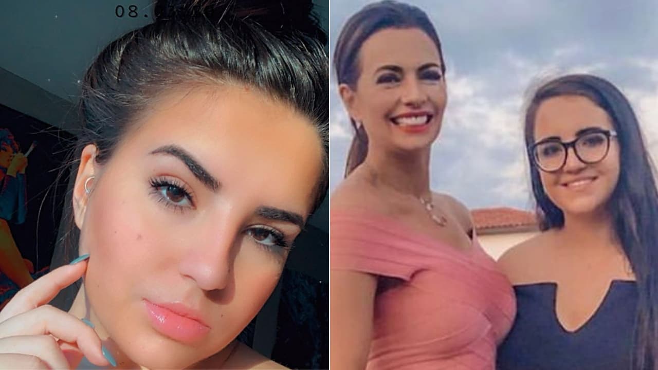 Hija de Cecilia Galliano habla del fuerte accidente que le dejó quemaduras: "Me quedaron marcas"