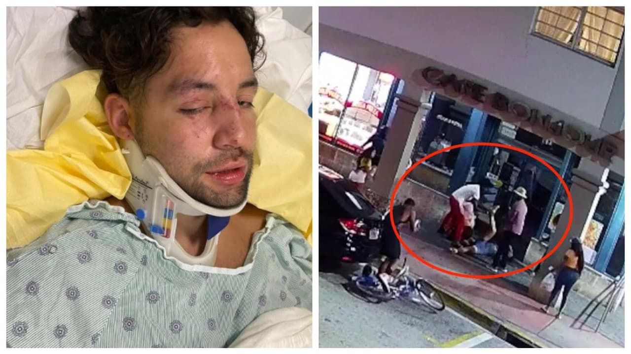 “Esto ya tiene que parar”: joven denuncia que le dieron una paliza por ser homosexual