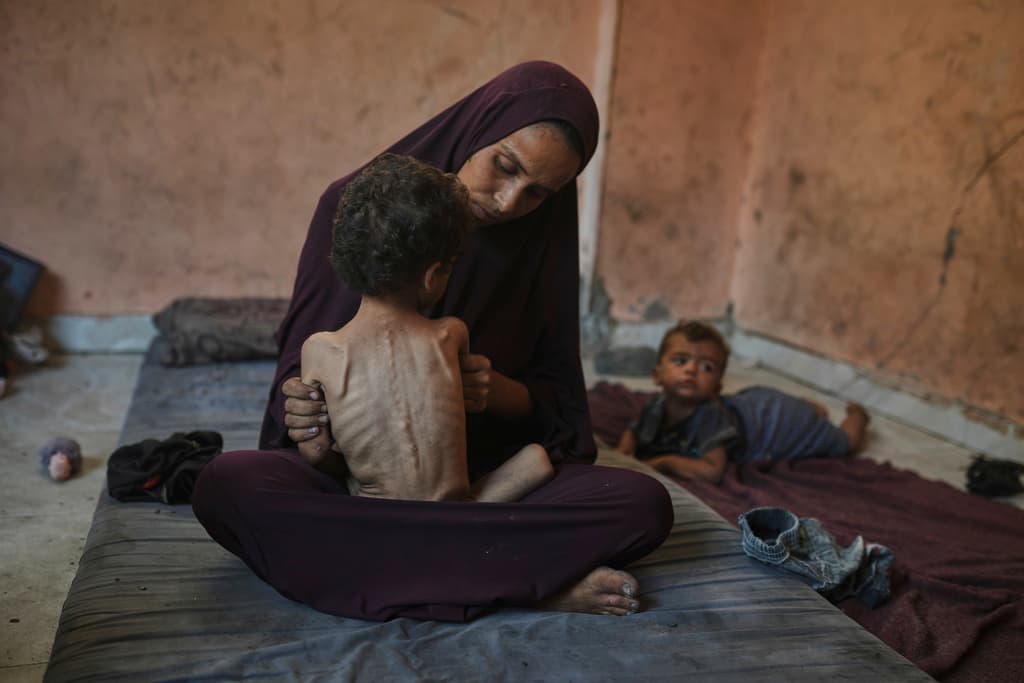 Naima Abu Ful posa para una foto con su hijo desnutrido de 2 años, Yazan, en su casa en el campo de refugiados de Shati, en la ciudad de Gaza, el miércoles 23 de julio de 2025.