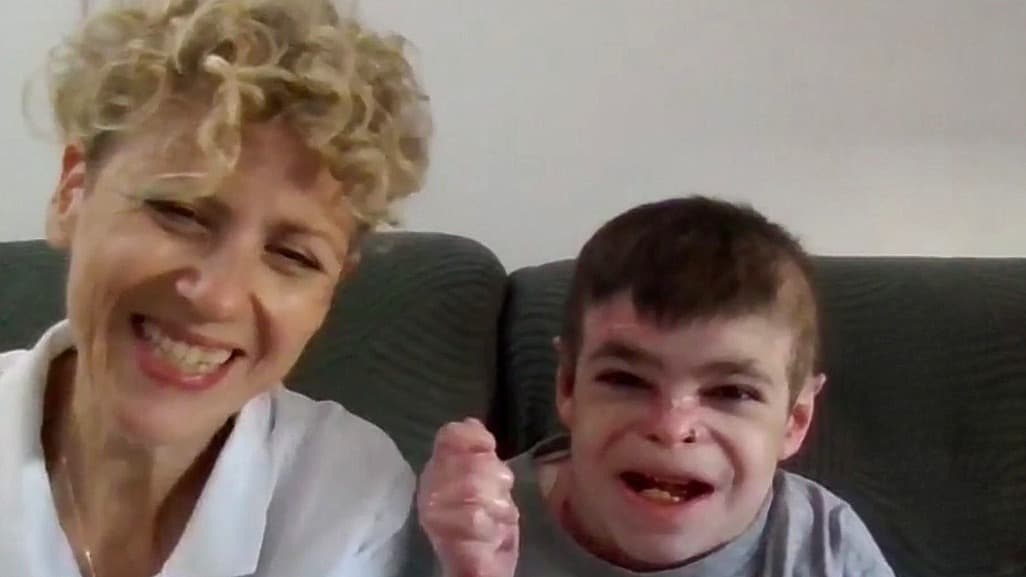 ¿Qué es la piel de mariposa? Entrevista con Leo Gutiérrez, un niño que construye sus sueños