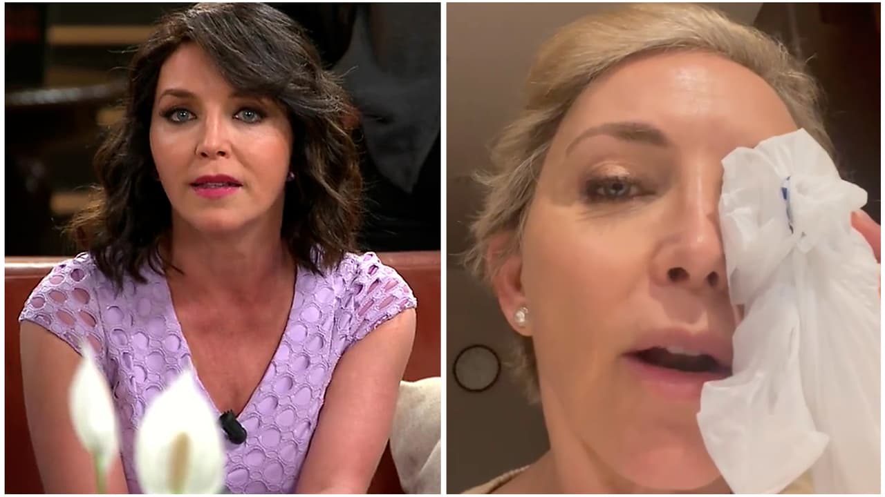 Laura Flores se dio tremendo "madrazo" en el ojo y quedó muy preocupada por cómo le quedará