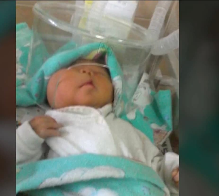 Tras dar a luz, el pequeño fue llevado de inmediato a recibir atención especial por la taquicardia que estaba sufriendo. Luego, cuando le dijeron que por fin podía verlo, no supo cómo reaccionar. 
<b>“Me quedé en shock”</b>, cuenta Álvarez, al recordar cómo fue observar la gran deformación que el bebé tenía en su cara. 
<br>