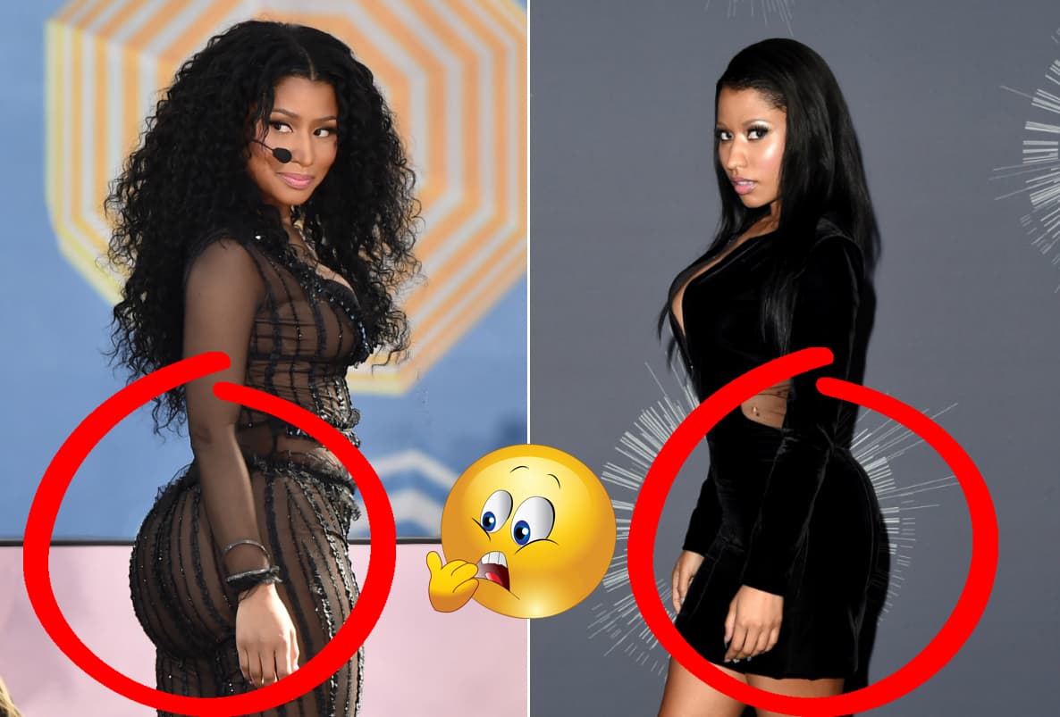 OMG! ¿Cuánto silicón habrán necesitado?