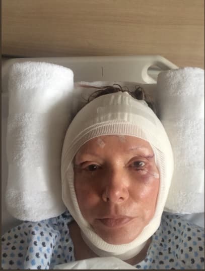 En octubre de 2017 la comediante volvió a entrar al quirófano, para quitarse las arrugas de los ojos, abrirse la mirada y algunos cambios en su nariz.