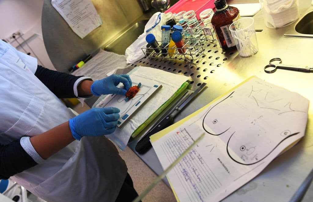 Nuevo medicamento aumenta la supervivencia de mujeres con cáncer de mama