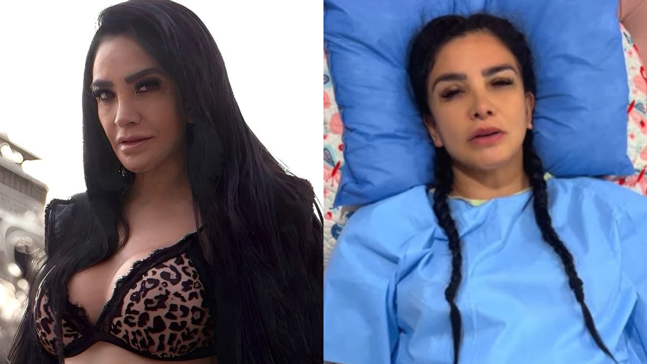 A la Wanders Lover le inyectaron aceite de cocina: pese a amputación su salud peligra