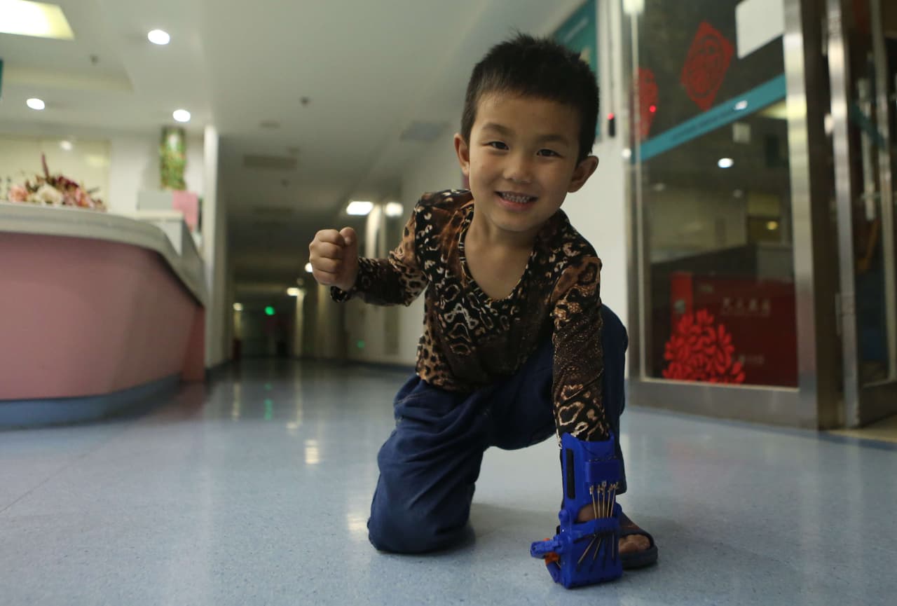 El niño recibió el miembro, ¡y fue gratis!