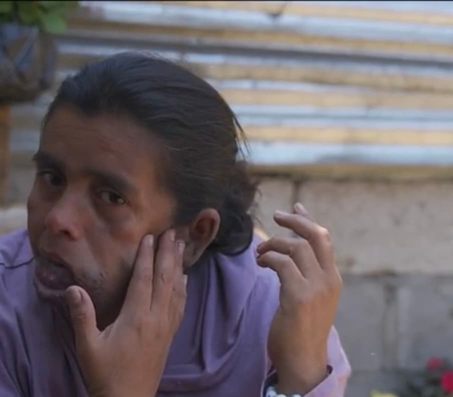 Y es que el desprecio por su apariencia también se instaló en su propia casa, cuando su propio padre llegó borracho e intentó asesinarla.
<b> “No sé cómo Dios me salvó aquella vez”</b>, recuerda. 
<br>