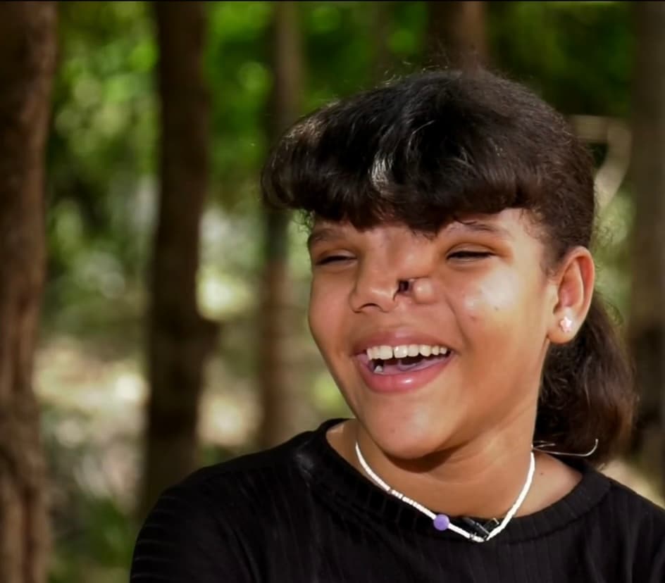 “Quiero poder hacerlo porque si me muero no habrá nadie para defenderla y yo quiero que todos la vean como una señorita normal, que pueda reírse y que salga al mundo”, dice la madre entre el llanto. 
<br>