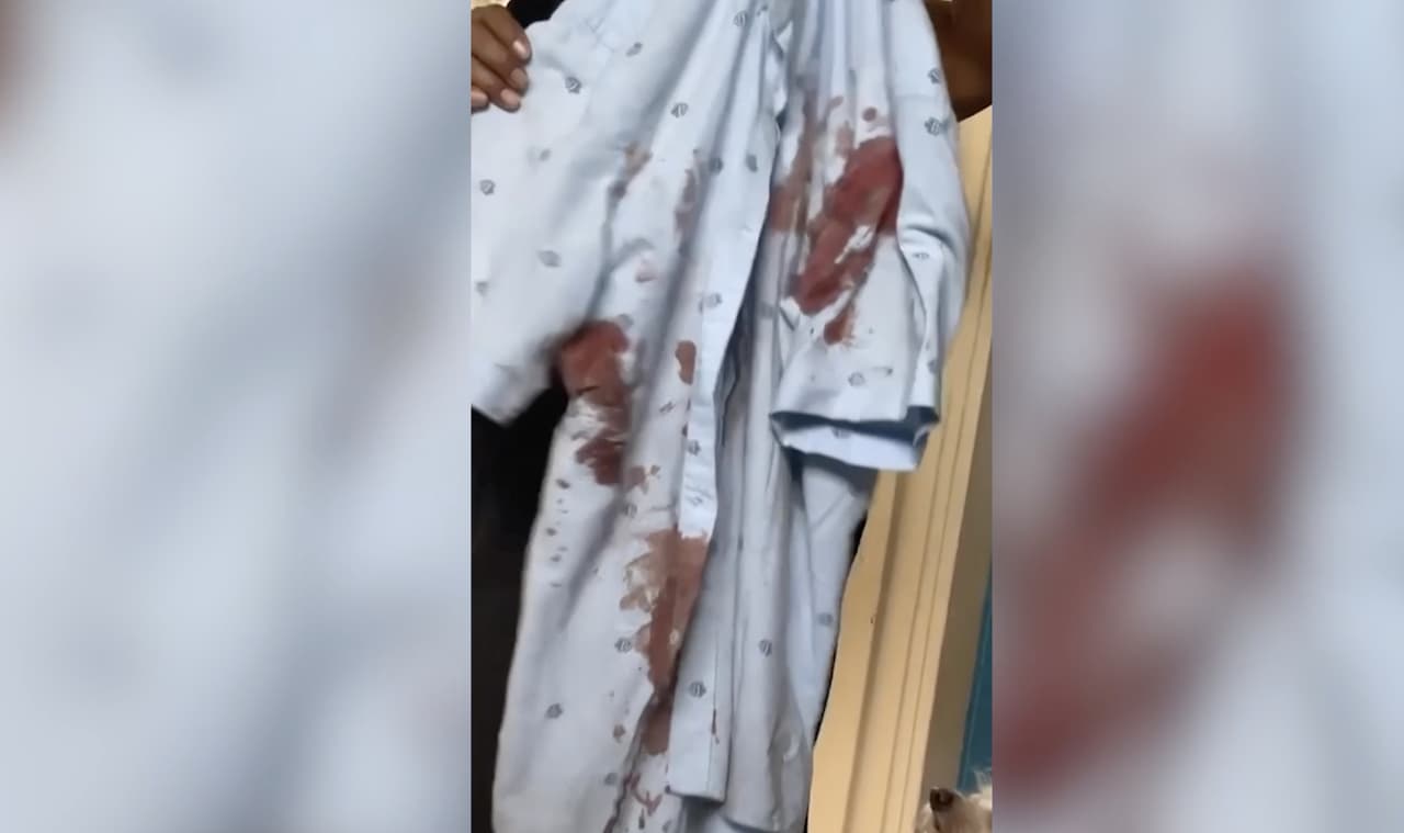 <a href="https://www.univision.com/local/los-angeles-kmex/video-capta-brutal-ataque-a-vendedor-ambulante-hispano-en-boyle-heights-video">Video captado en el lugar</a> muestra cómo 
<b>el sospechoso lo agrede y cuando Torres cae al suelo comienza a apuñalarlo con violencia. </b>"Yo pienso que si no se hubiera metido nadie por lo menos a grabar lo que grabaron si me hubiera matado ahí", dijo Torres.