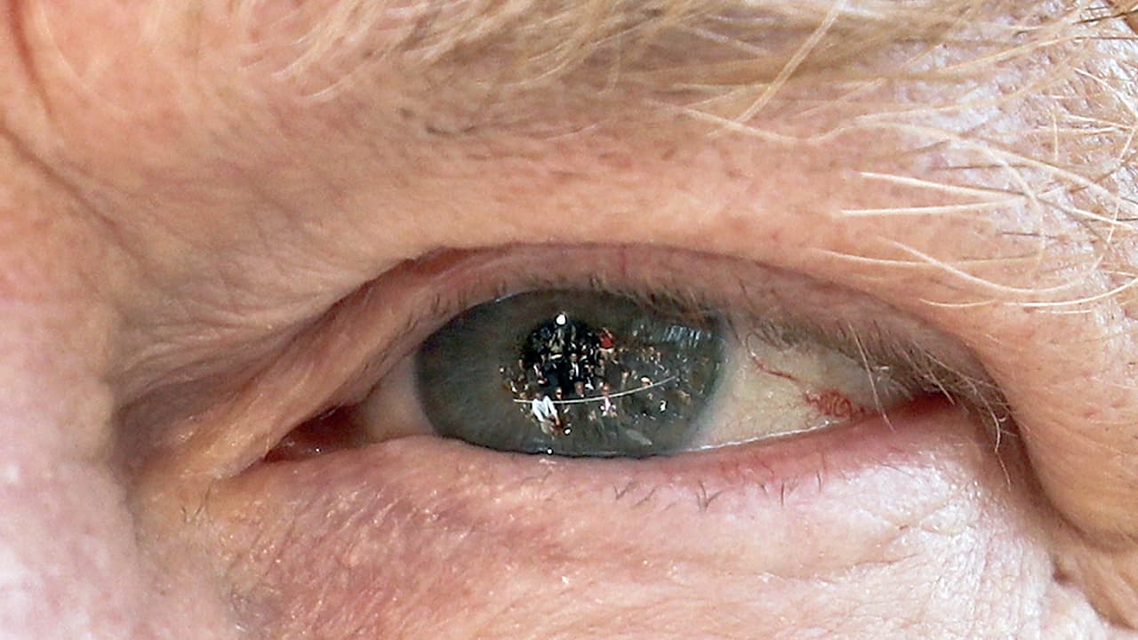 Por qué se hizo viral esta foto del ojo del presidente Donald Trump