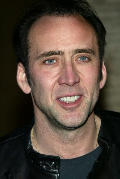 Nicolas Cage era un famoso de Holllywood con horrenda sonrisa. Poco a poco notó que esto afectaba su aspecto y lo hacía lucir viejo y desgastado.