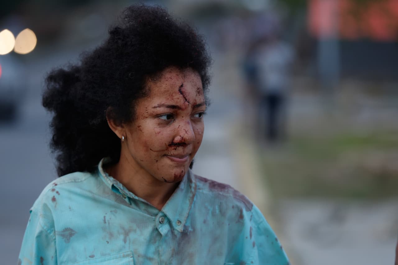 Una mujer herida camina por La Guaira, Venezuela, un día después del terremoto que azotó la zona, el jueves 25 de junio de 2026.