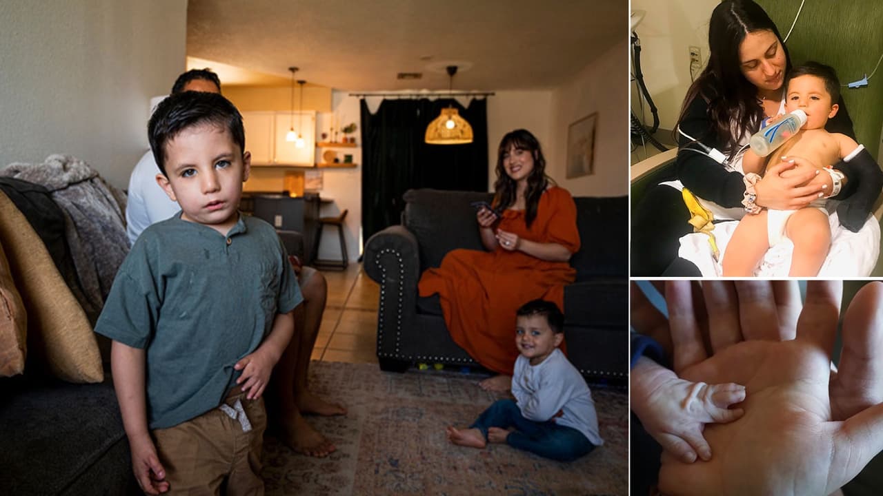 Una madre en Yuma documenta la lucha de su hijo de 4 años con el raro síndrome de Moebius
